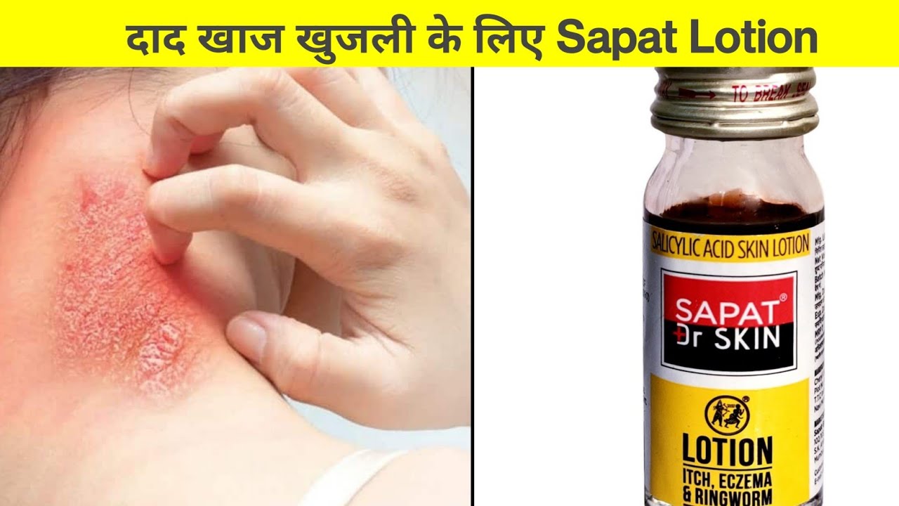 how to use sapat lotion daad khaj khujli ringworm hindi YouTube