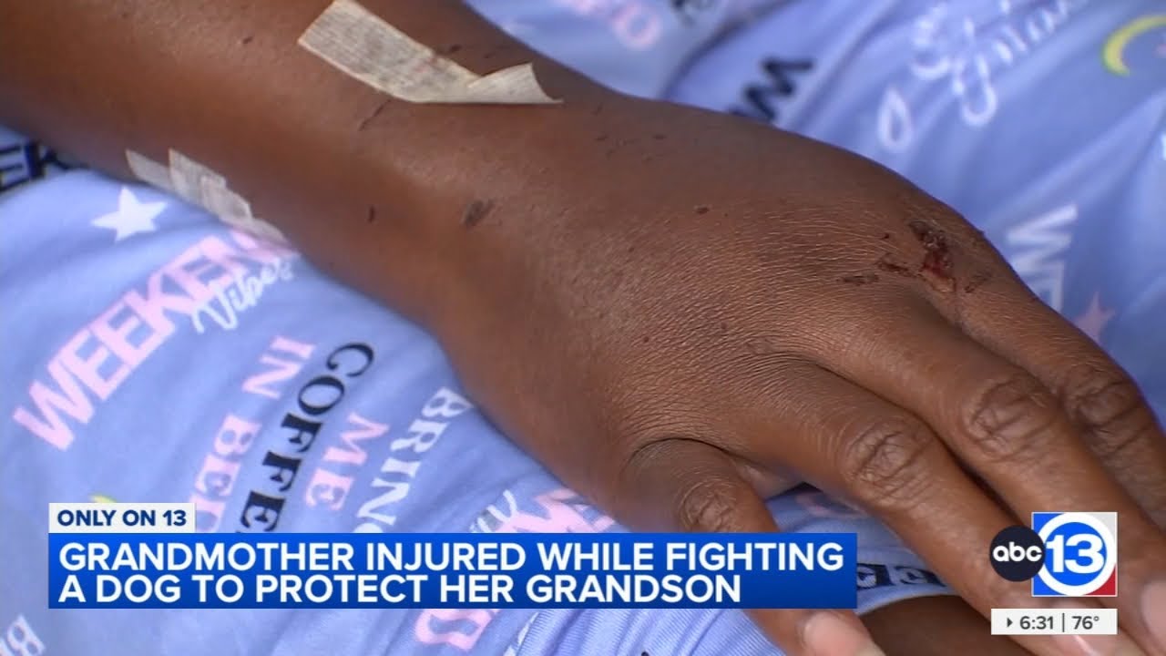 Woman attacked by dog shares her recovery story - YouTube
