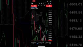XAU/USD New York Session Open killed.🤯🤯🔪 #trading