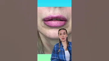 Белые точки на губах. Что это? Чем опасно?