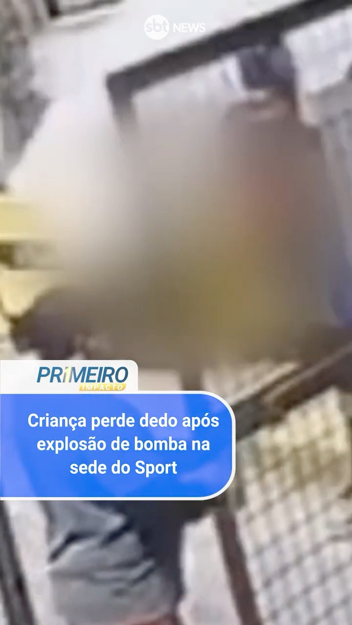 Criança perde dedo após explosão de bomba na sede do Sport