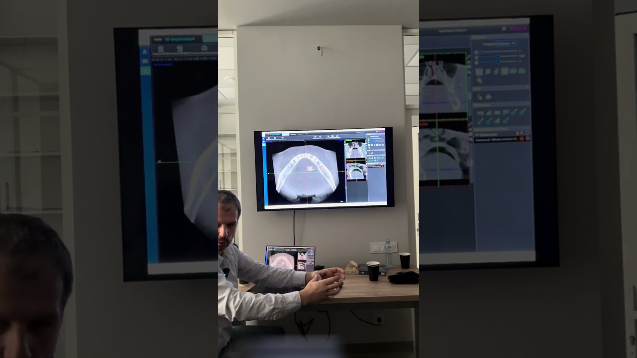 Работа в romexis viewer 6