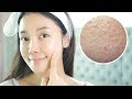 ENG) 좁쌀여드름! 스킨케어 이렇게 하세요 Skincare for Millet Seed Acne MSA | 뷰티클라우드 유나 UNA