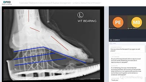 Functional Treatment of Achilles Tendon Ruptures -...