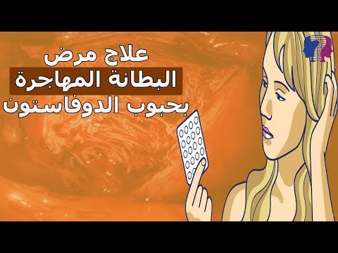هل حبوب الدوفاستون و حبوب فيزان علاج مجرب للبطانة المهاجرة وكيف يتم استخدامهما