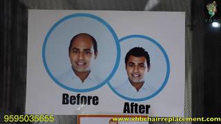Non Surgical Hair Transplant at VHBC Pune  9595035655