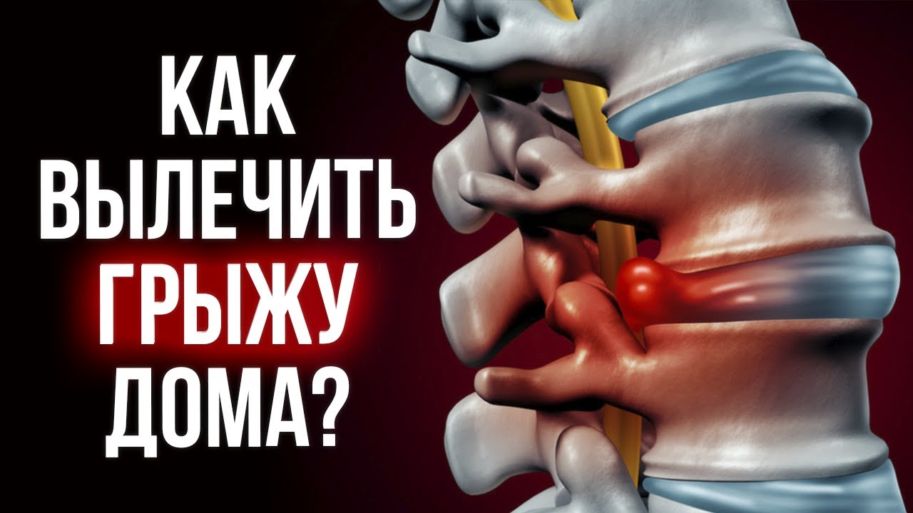 Как избавиться от МЕЖПОЗВОНКОВОЙ ГРЫЖИ? / 3 упражнения для здоровой ...