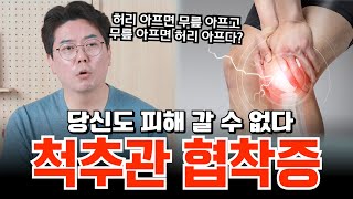 무릎이 아픈 당신 혹시 척추관 협착증? 디스크만 허리 아픈게 아니다! 신경외과 전문의가 알려주는 척추관 협착증| 의학 전문채널
