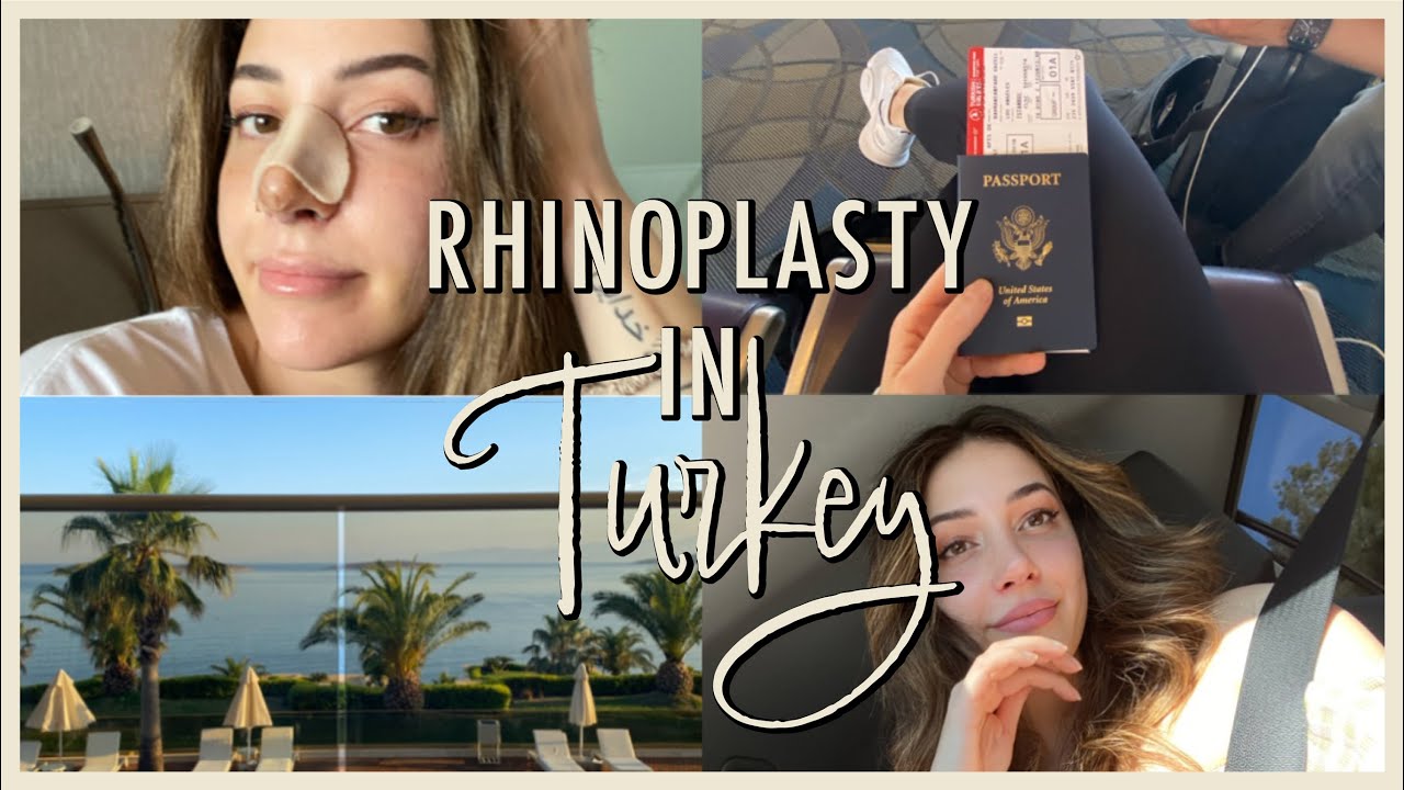 Rhinoplasty in Turkey | USA Patient | Dr. Muhammet Dilber