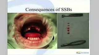 Dr. Rob Beaglehole - 'SSB's and Oral Health' screenshot 1