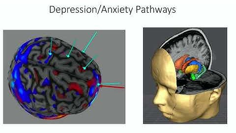 OHBM 2025 | Educational Course | How to Use MRI to Optimize Brain Stimulation | Part 8