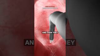 Shrink Your Stomach Without Surgery Surgeon Reacts