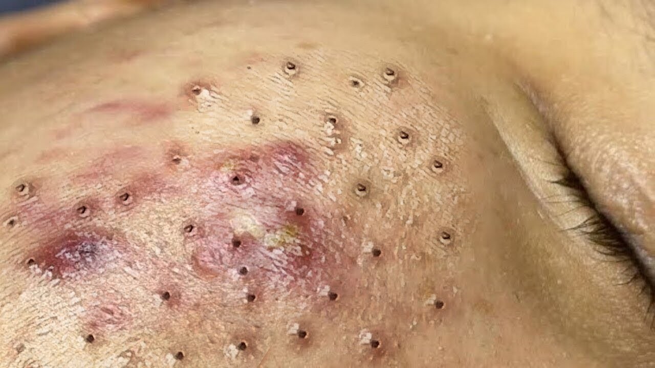 𝑺𝒐𝒐𝒕𝒉𝒊𝒏𝒈 𝑭𝒂𝒄𝒊𝒂𝒍 𝑻𝒓𝒆𝒂𝒕𝒎𝒆𝒏𝒕 𝒇𝒐𝒓 𝑺𝒕𝒓𝒆𝒔𝒔 𝑹𝒆𝒍𝒊𝒆𝒇 | 𝑫𝒆𝒆𝒑 𝑪𝒍𝒆𝒂𝒏𝒊𝒏𝒈 & 𝑪𝒂𝒍𝒎𝒊𝒏𝒈 𝑴𝒂𝒔𝒔𝒂𝒈𝒆 𝒂𝒕 𝑳𝒖𝒙𝒖𝒓𝒚 𝑺𝒑𝒂 #48150