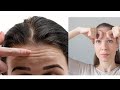 3 Very Easy Exercises to reduce Forehead Wrinkles in Hindi (Results in 15 days)