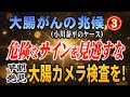 【大腸がんの兆候】③ (小川泰平のケース) 危険なサインを見逃すな！ 早期発見… 大腸カメラ検査を！【小川泰平の事件考察室】# 2853