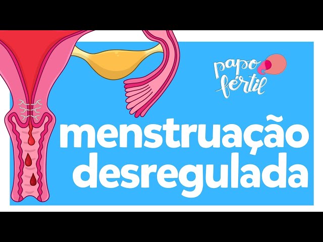 Menstruação desregulada, o que pode ser?, Papo Fértil