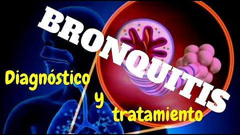 ¿Cómo se trata la bronquitis en urgencias?