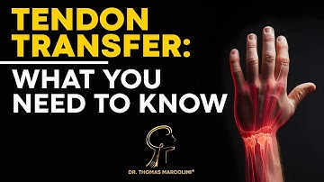 Lost Movement? Discover Tendon Transfer Surgery!