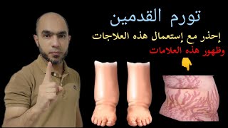 ما سبب تورم القدمين د يوسف الملاحي@Dr_youssef by أسرار الطب والغدد الصماء 2,200 views 7 months ago 9 minutes, 32 seconds