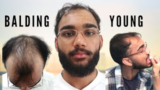 BALDING Before 20 - My Journey Overcoming Balding Insecurity