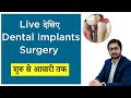 Live dental implants surgery  start to end all steps       