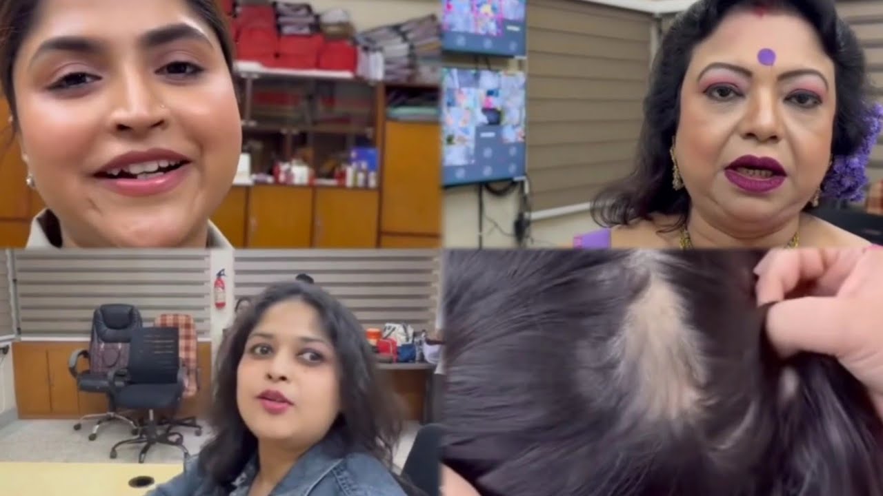 দিদি ভাইয়ের টাক মাথায় নতুন চুল গজালো 😍❤অ্যালোপেসিয়ার Treatment 