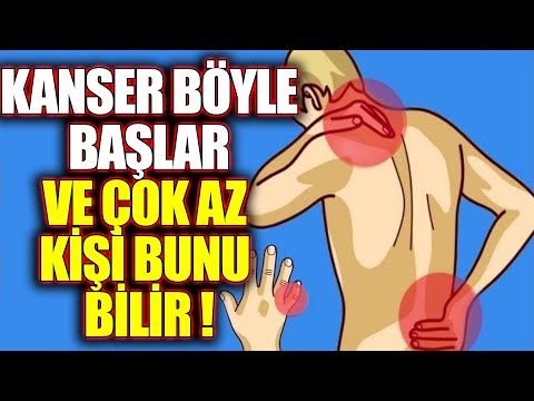 Kanser Olduğunuzu Gösteren 20 İşaret ! Bu Belirtilerden Biri Bile Varsa Hemen Doktora Gidin !