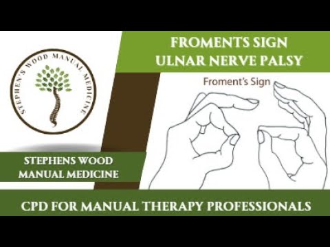 Froment S Sign For Ulnar Nerve Palsy