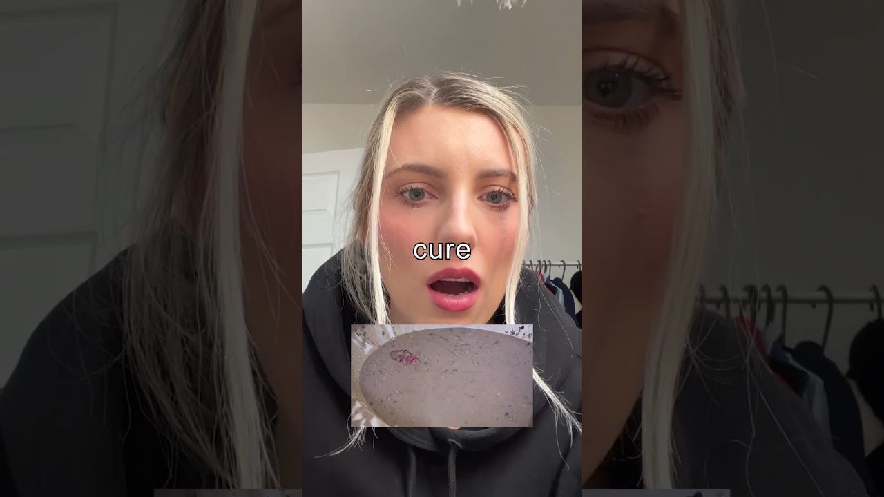 I cured my allergy in 20 minutes