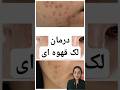 ساب نکنی پوستت نابود میشه درمان لک قهوه ای ک جای جوش همینه پوست لک درمان لک 