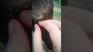 Botfly Egg Removal On A Horses Leg.