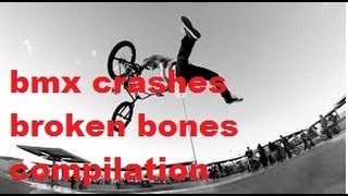 BMX crashes broken bones compilation