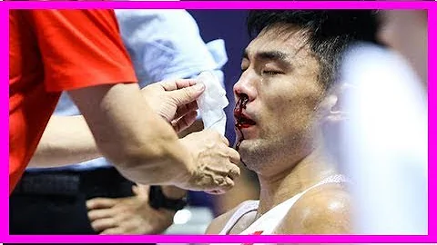 杜锋怒了！阿的江爱子被搀下场+国产魔兽流鼻血 热身赛已然变味 - 天天要闻