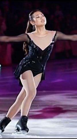 柔らかすぎる関節が仇となり、足首の骨挫傷で…#衝撃の現在#太田由希奈#アイススケート