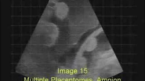 Ultrasound Pregnancy Testing 3rd Trimester Cows with ReproScan XTC