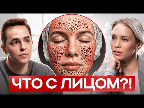 Биоревитализация : правда об уколах красоты, о которой молчат косметологи | Подкаст
