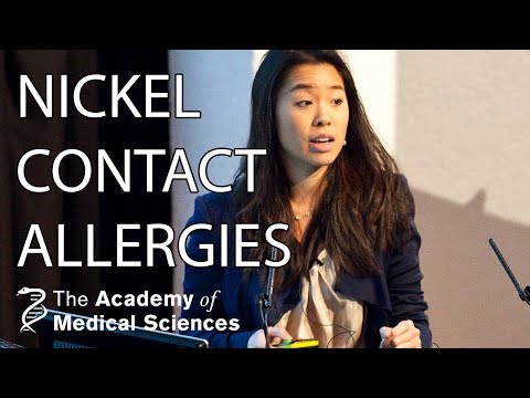 Causes of nickel skin allergies | Dr Teresa Tsakok