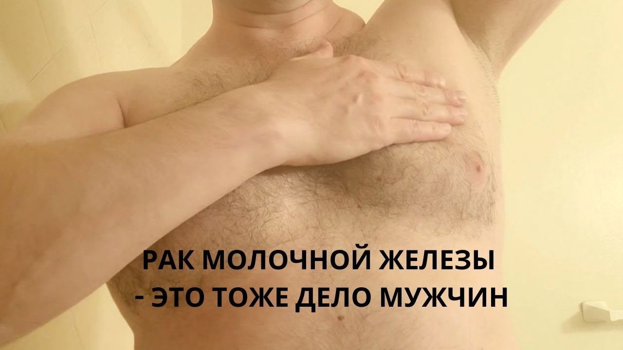 Диагностика и лечение гинекомастии в Санкт-Петербурге