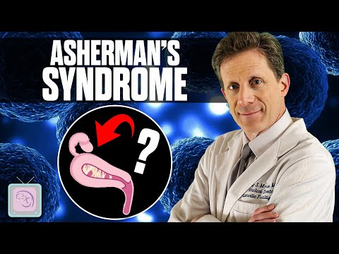 Video: Plodnost A-Z: Ashermanův syndrom
