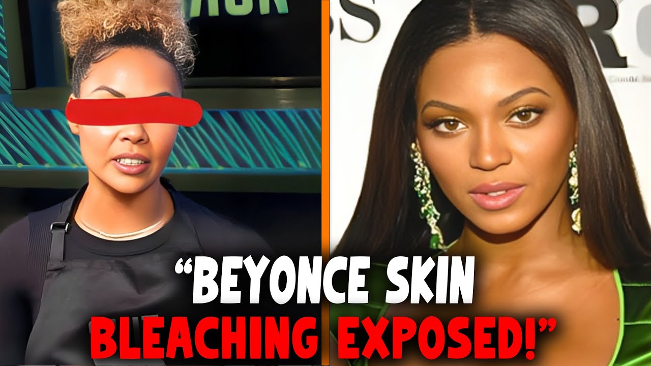 Beyoncé’s Team EXPOSES Her Skin Bleaching Secrets!
