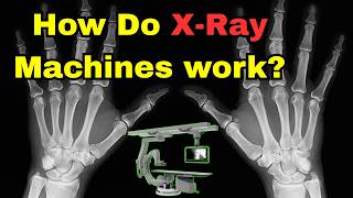 How Do X-Ray Machines See Through Your Body? (explained in 4 minutes)