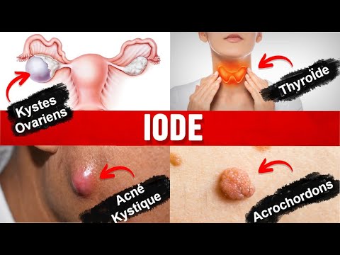 Vidéo: Faut-il prendre des suppléments d'iode avec de la nourriture ?