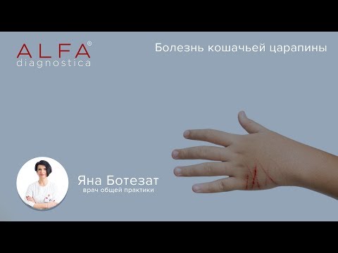 [AlfaMedBlog] 10: Чем опасна болезнь кошачьей царапины?