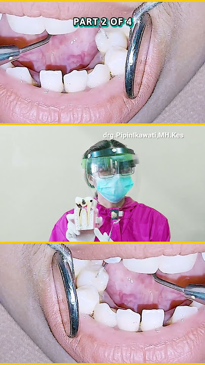 Download lagu ABAB MAMBU - PART 2 OF 4