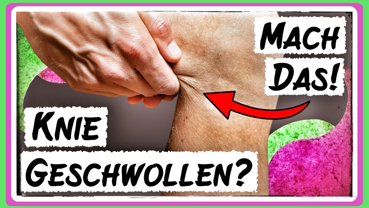 Behandle ein dickes Knie mit Wassereinlagerung, eine Knieschwellung