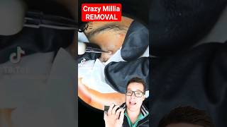 Crazy Huge Milia Removal - How To Get Rid Of Milia 