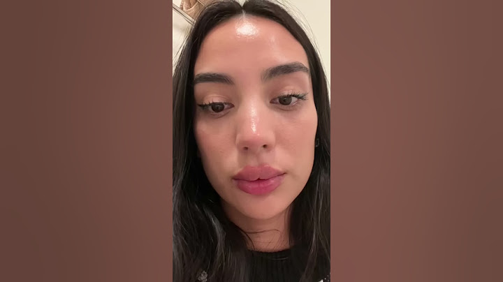 ME INYECTE LOS LABIOS 👄 Y SALIÓ MAL 😩.... bueno no tan mal 😂 Ácido hialurónico en labios