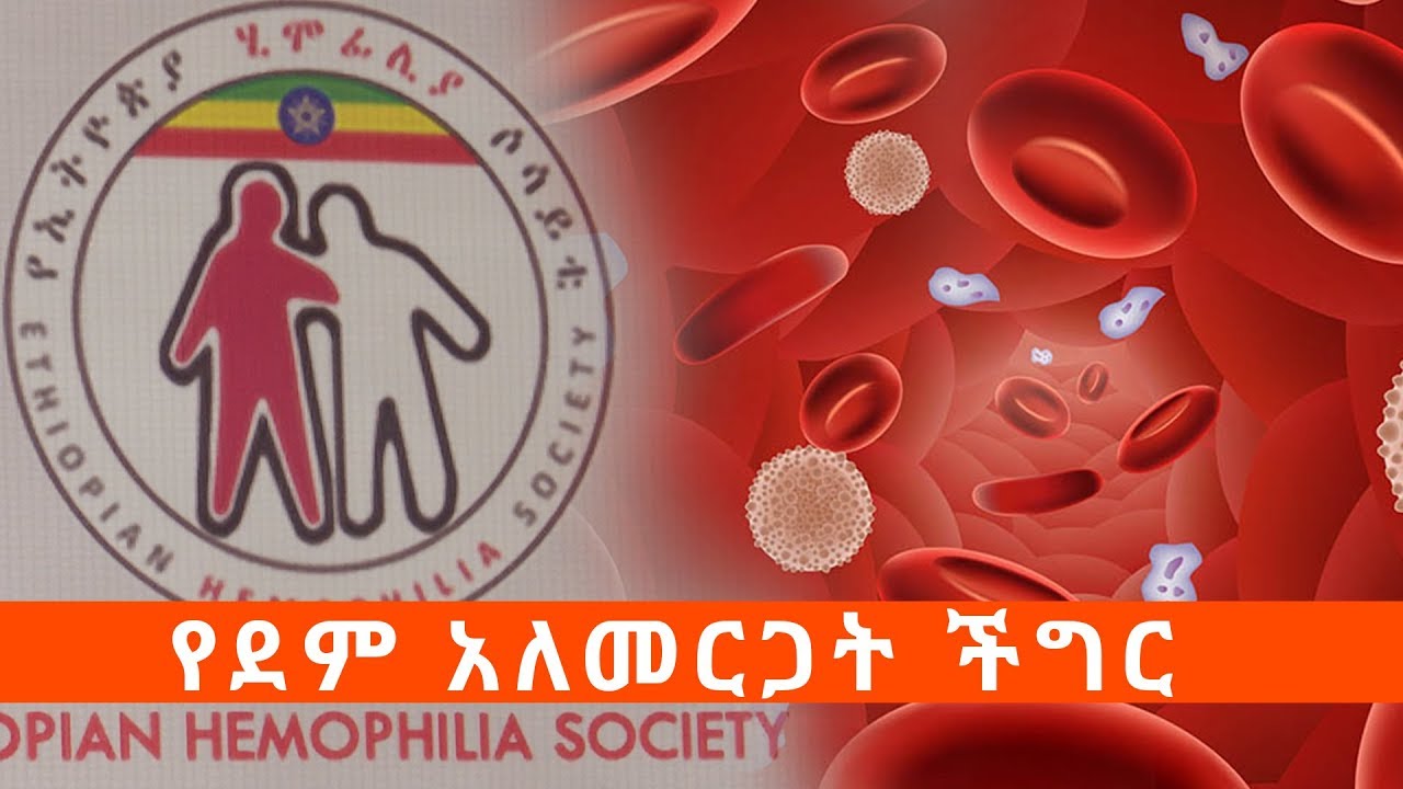 የደም አለመርጋት ችግር Hemophilia   ኢቢኤስ አዲስ ነገር EBS What's New April 16, 2019