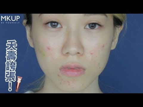 MKUP美咖【瘀青、痘痘💢 隨意擦輕鬆遮🔪】