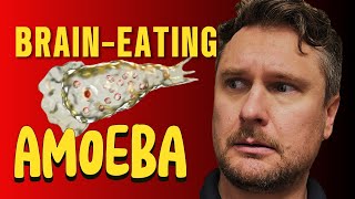 Rv Water Warning Woman Dies From Brain-Eating Amoeba How To Stay Safe